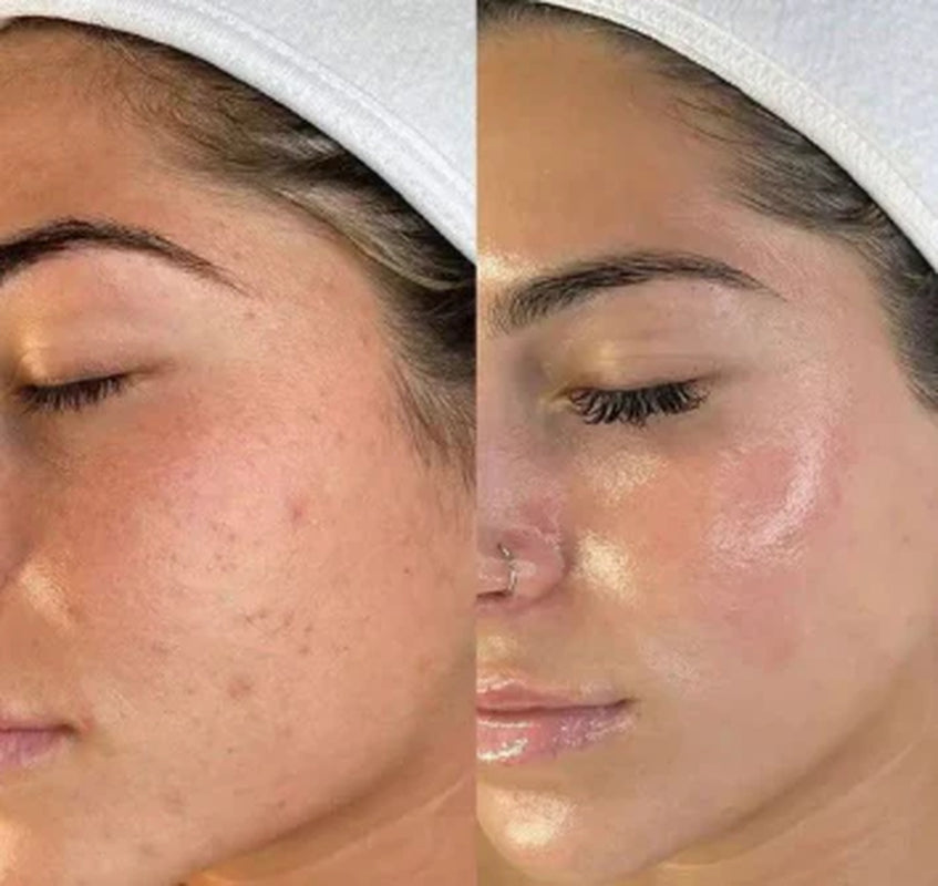 Peel Shot Rice Ampoule Duo